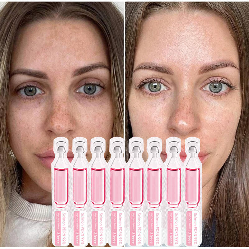 Zalmserum Eiwit Peptide Essent - Collagen Peptide Powder recensie en prijs